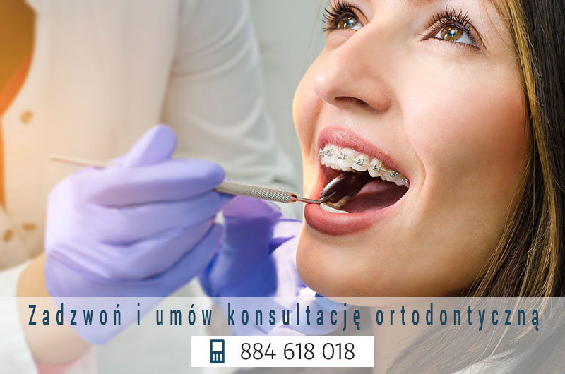 konsultacja-ortodontyczna grodzisk mazowiecki